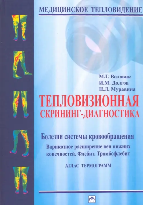 Тепловизионная скрининг-диагностика. Болезни системы кровообращения. Варикозное расширение вен, Голубой
Тепловизионная скрининг-диагностика. Болезни системы кровообращения. Варикозное расширение вен, Голубой