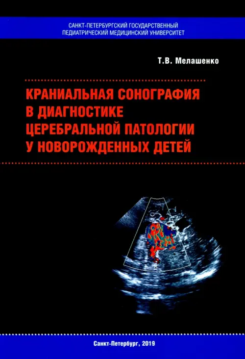 Краниальная сонография в диагностике церебральной патологии у новорожденных детей, Чёрный
Краниальная сонография в диагностике церебральной патологии у новорожденных детей, Чёрный