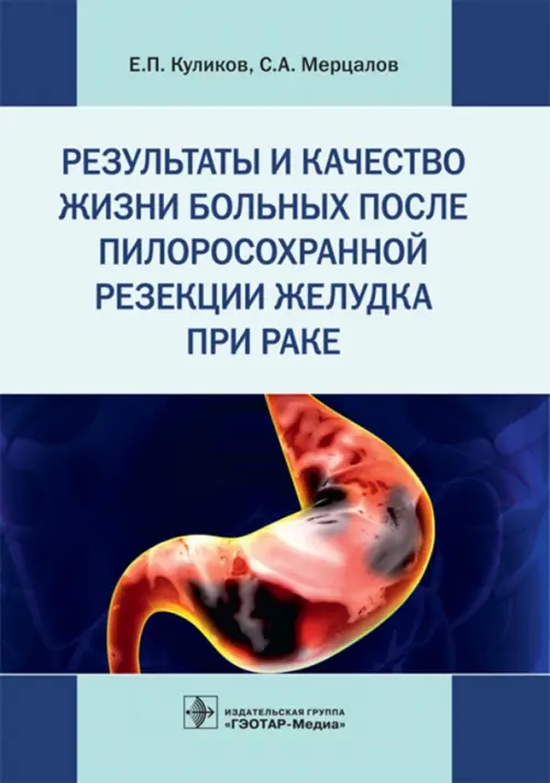 Результаты и качество жизни больных после пилоросохранной резекции желудка при раке
Результаты и качество жизни больных после пилоросохранной резекции желудка при раке