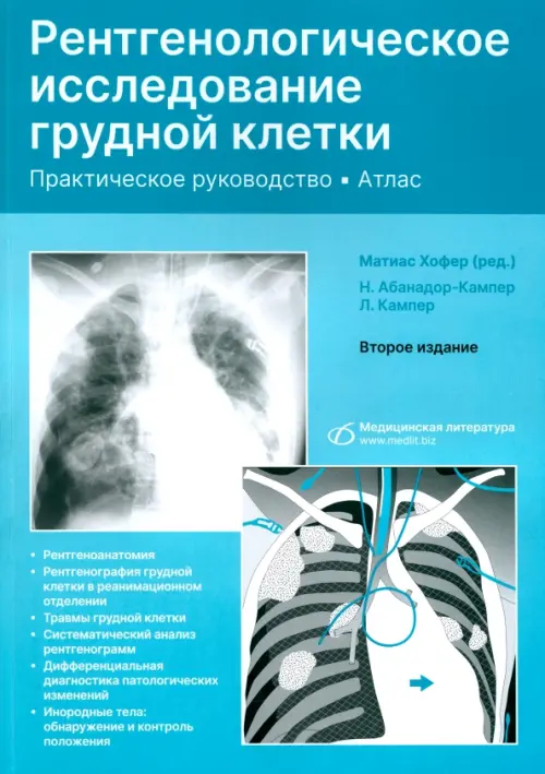 Рентгенологическое исследование грудной клетки. Практическое руководство. Атлас, Голубой
Рентгенологическое исследование грудной клетки. Практическое руководство. Атлас, Голубой