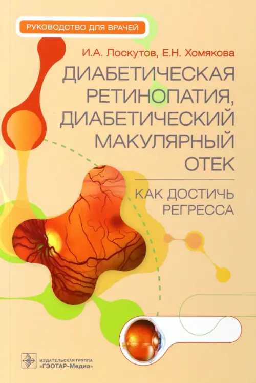 Диабетическая ретинопатия, диабетический макулярный отек - как достичь регресса. Руководство, Оранжевый
Диабетическая ретинопатия, диабетический макулярный отек - как достичь регресса. Руководство, Оранжевый