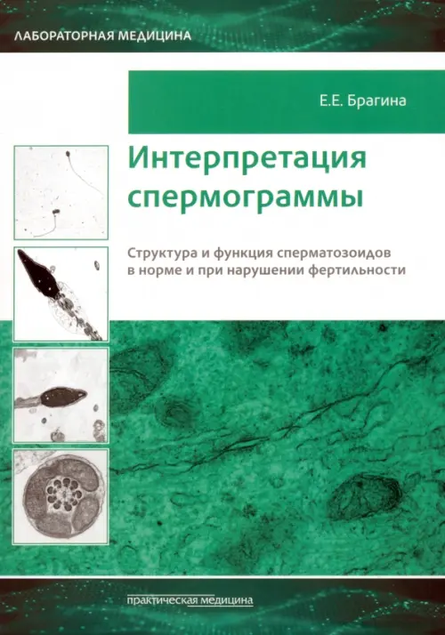 Интерпретация спермограммы. Структура и функция сперматозоидов в норме и при нарушении фертильности, Зелёный
Интерпретация спермограммы. Структура и функция сперматозоидов в норме и при нарушении фертильности, Зелёный