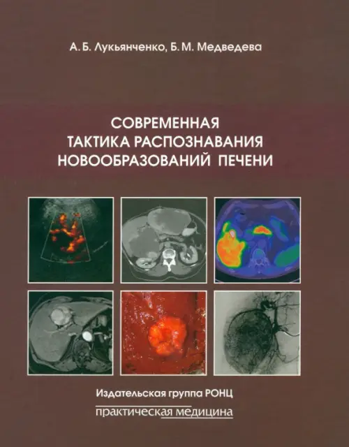 

Современная тактика распознавания новообразований печени, Красный