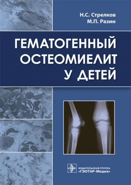 

Гематогенный остеомиелит у детей, Синий