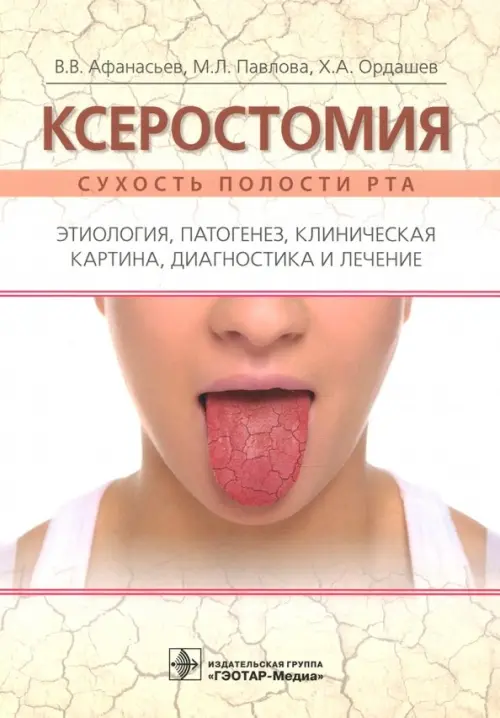

Ксеростомия. Сухость полости рта. Этиология, патогенез, клиническая картина, диагностика и лечение, Жёлтый