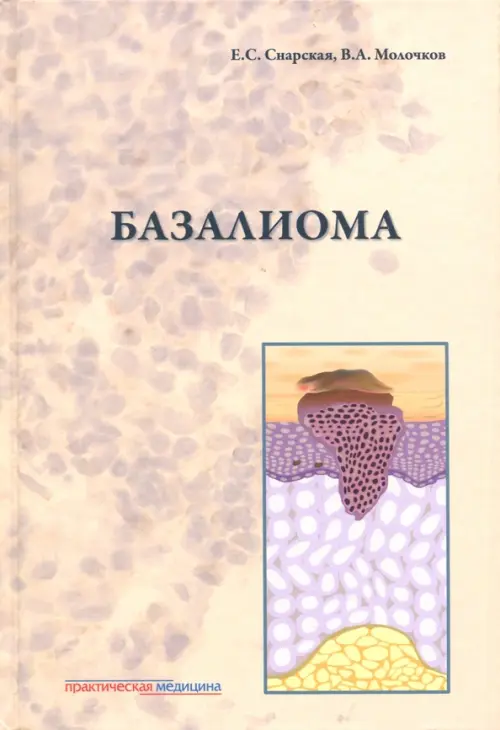 

Базалиома, Оранжевый