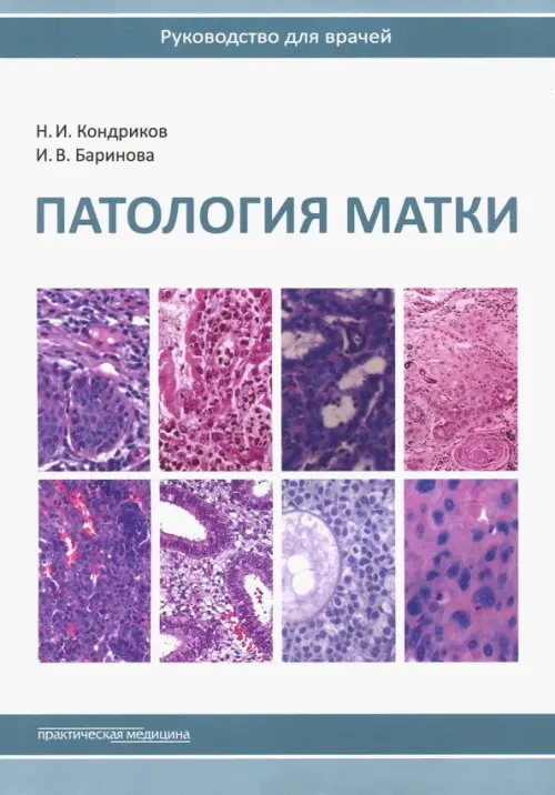

Патология матки. Руководство для врачей, Белый