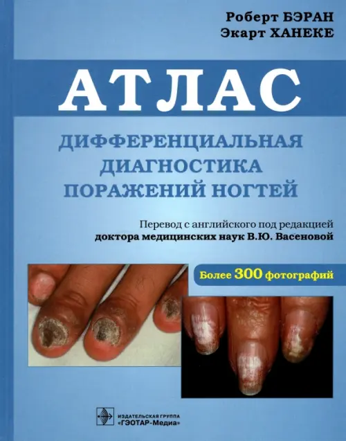 

Дифференциальная диагностика поражений ногтей. Атлас, Голубой
