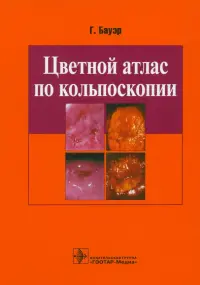 Цветной атлас по кольпоскопии