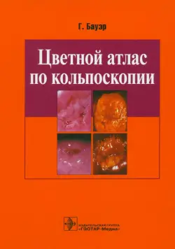 Цветной атлас по кольпоскопии