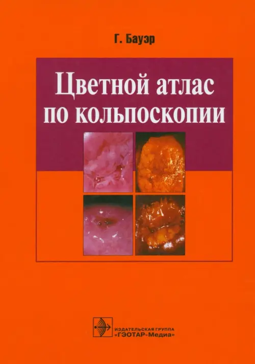 Цветной атлас по кольпоскопии