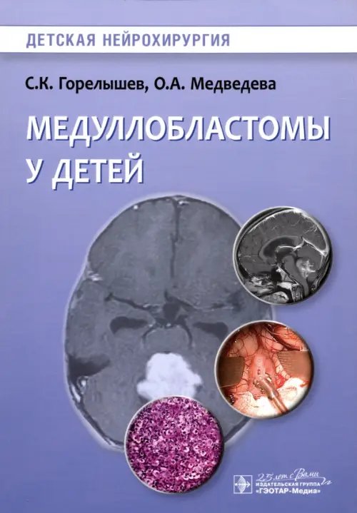 

Медуллобластомы у детей. Руководство, Фиолетовый