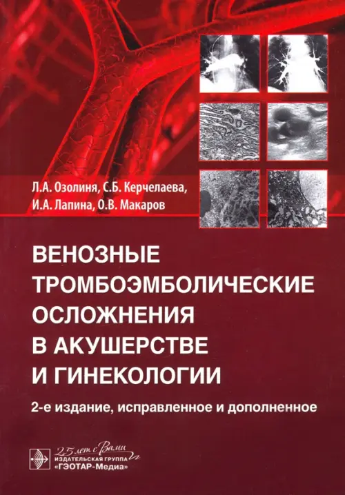 

Венозные тромбоэмболические осложнения в акушерстве, Красный