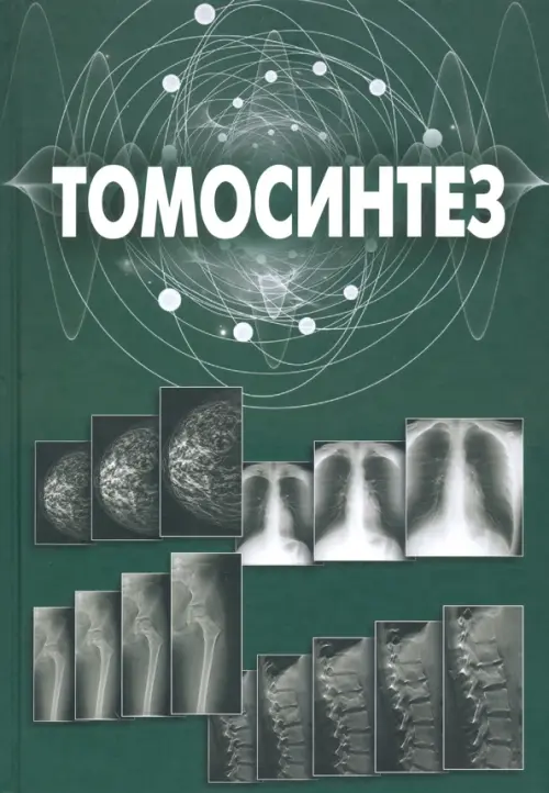 

Томосинтез, Зелёный