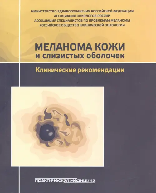 

Меланома кожи и слизистых оболочек. Клинические рекомендации