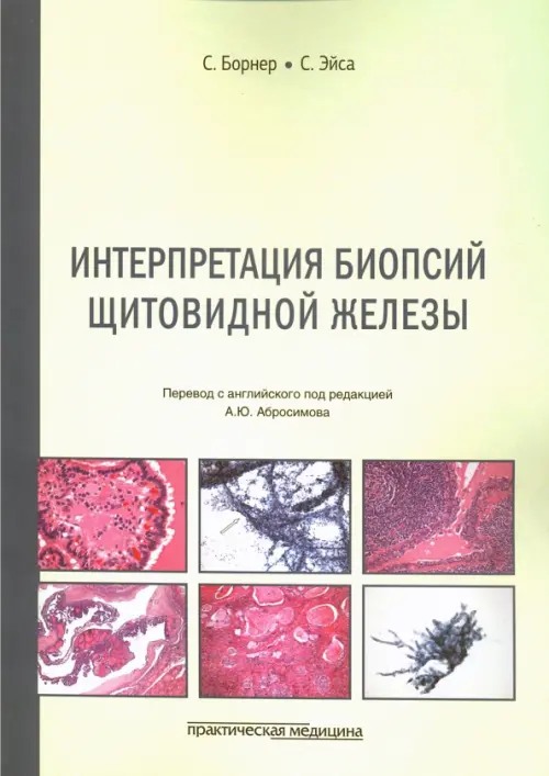 

Интерпретация биопсий щитовидной железы, Зелёный