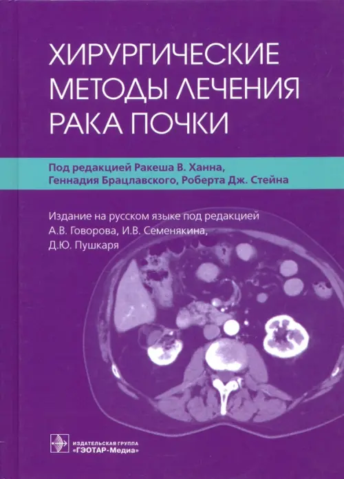 

Хирургические методы лечения рака почки, Фиолетовый