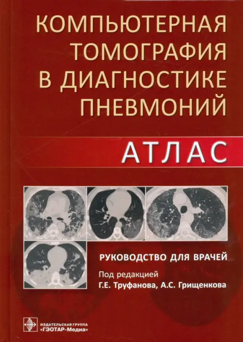 

Компьютерная томография в диагностике пневмоний. Атлас, Красный