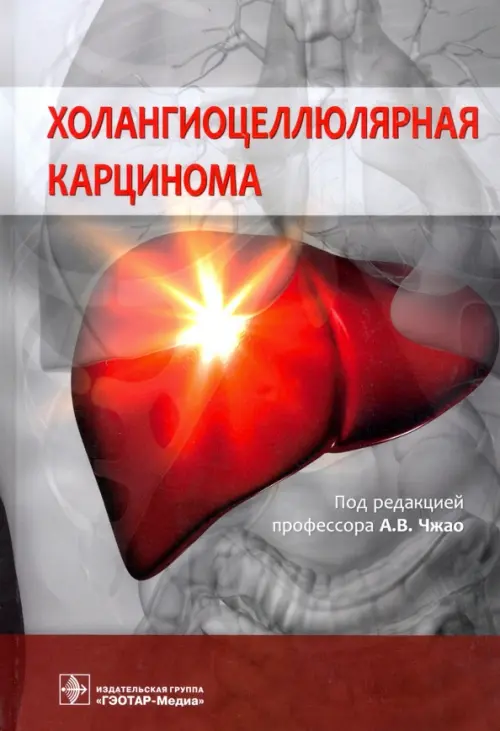 

Холангиоцеллюлярная карцинома, Серый