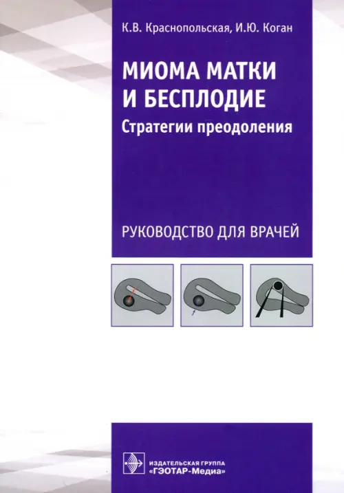 

Миома матки и бесплодие. Стратегии преодоления, Белый