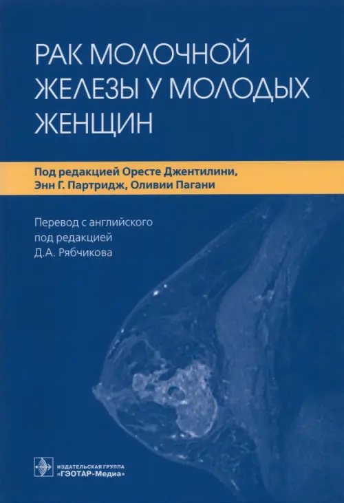 

Рак молочной железы у молодых женщин, Синий