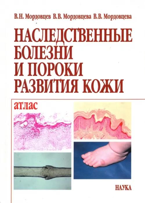 

Наследственные болезни и пороки развития кожи. Атлас, Белый