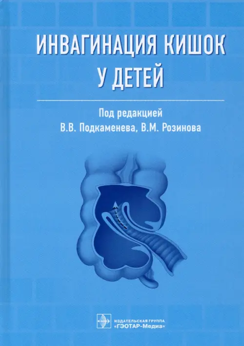 Инвагинация кишок у детей. Руководство