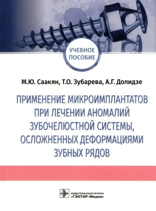 Применение микроимплантатов при лечении аномалий зубочелюстной системы, осложненных деформациями