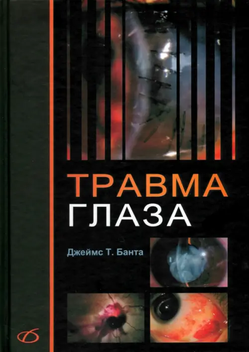 

Травма глаза, Чёрный