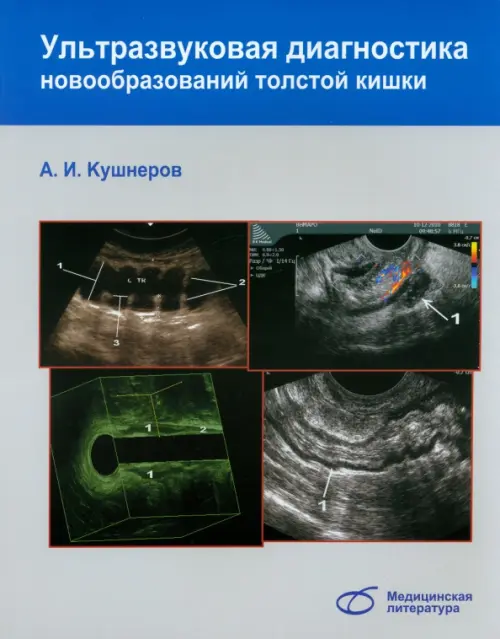 

Ультразвуковая диагностика новообразований толстой кишки, Серый