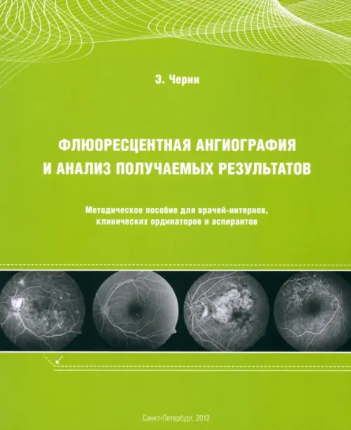 Флюоресцентная ангиография и анализ получаемых результатов. Методическое пособие для врачей-интернов