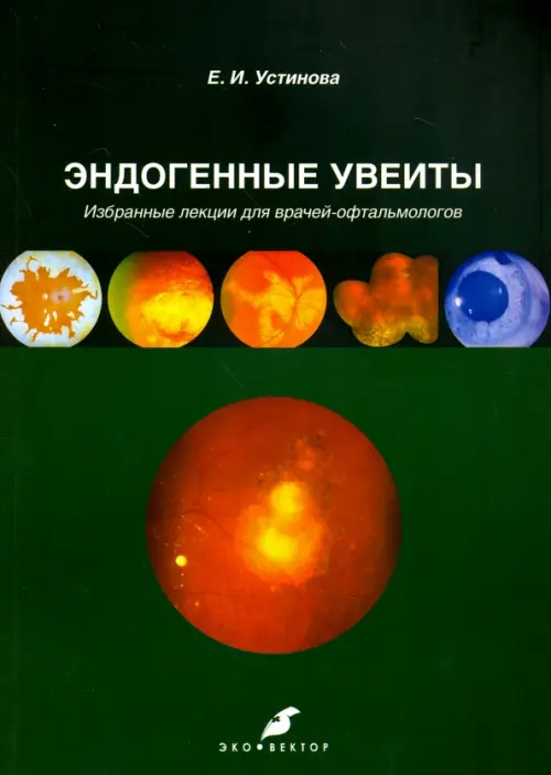 

Эндогенные увеиты. Избранные лекции для врачей-офтальмологов, Зелёный