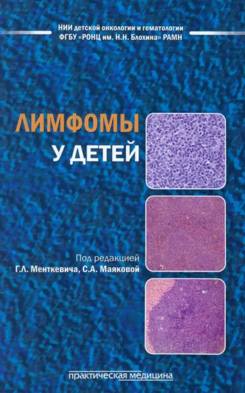 

Лимфомы у детей, Синий