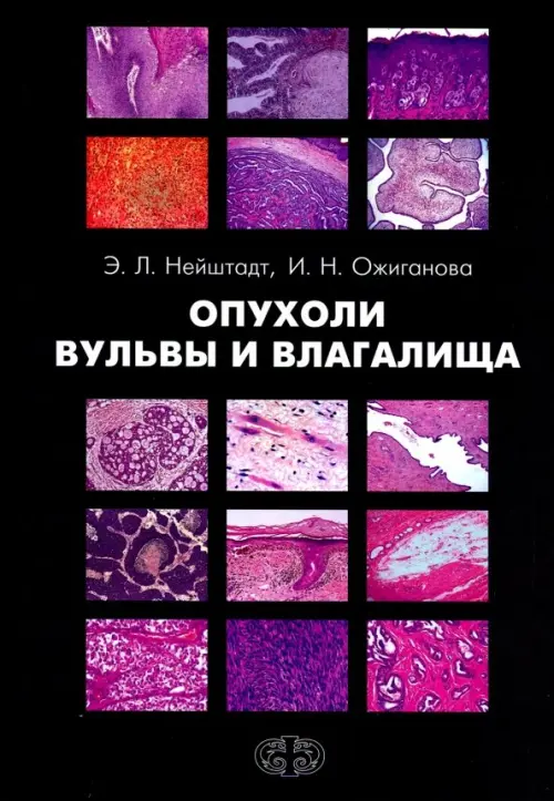 

Опухоли вульвы и влагалища, Чёрный