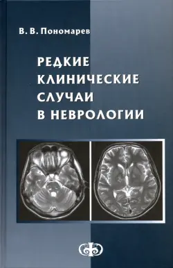 Редкие клинические случаи в неврологии (случаи из практики). Руководство для врачей