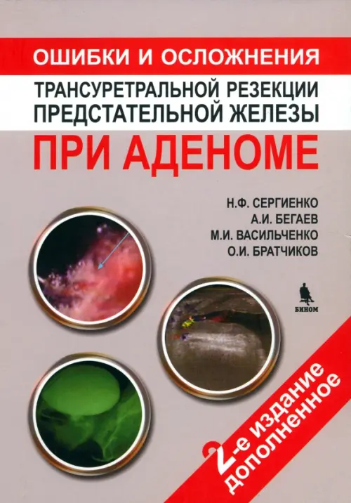 

Ошибки и осложнения трансуретральной резекции предстательной железы при аденоме, Серый