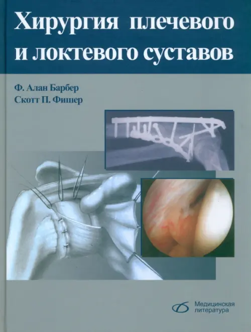 

Хирургия плечевого и локтевого суставов, Серый