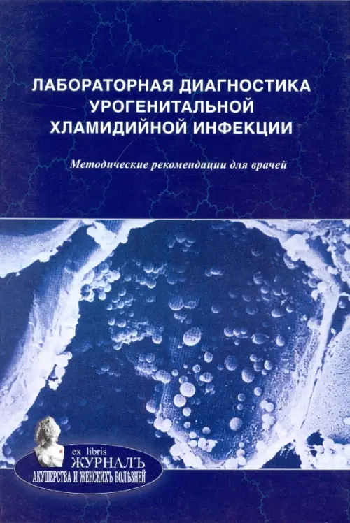 Лабораторная диагностика урогенитальной хламидийной инфекции. Методические рекомендации для врачей