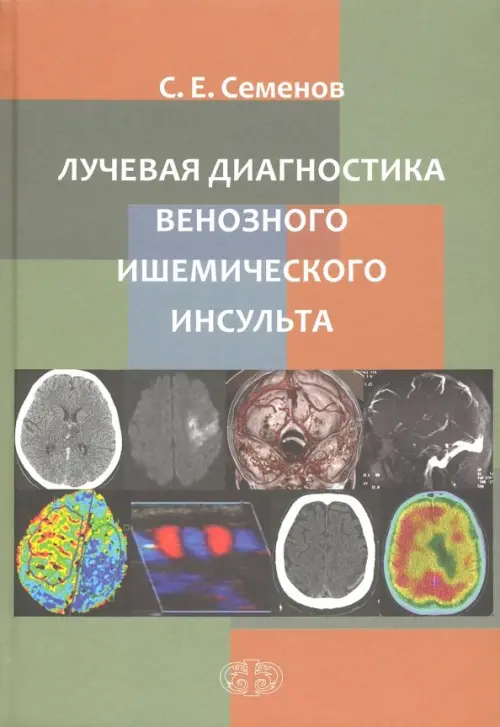 

Лучевая диагностика венозного ишемического инсульта