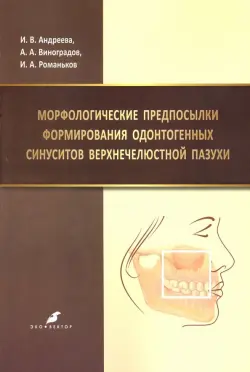 Морфологические предпосылки формирования одонтогенных синуситов верхнечелюстной пазухи