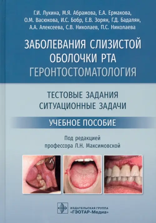 

Заболевания слизистой оболочки рта. Геронтостоматология. Тестовые задания, ситуационные задачи, Голубой