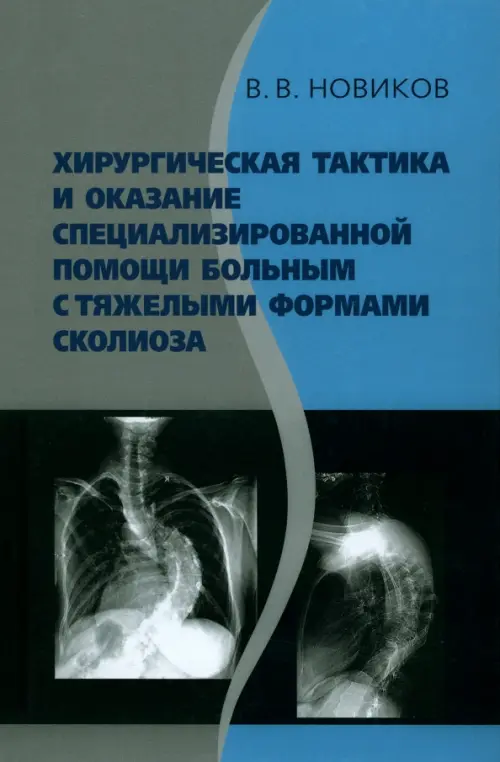 

Хирургическая тактика и оказание специализированной помощи больным с тяжёлыми формами сколиоза