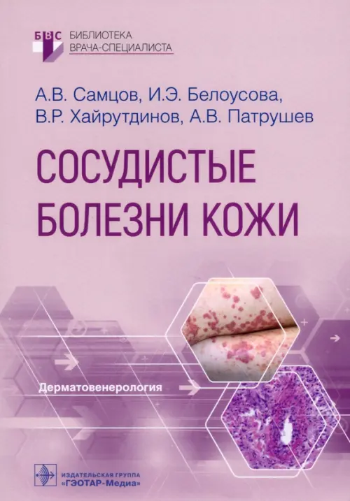 

Сосудистые болезни кожи. Руководство, Фиолетовый