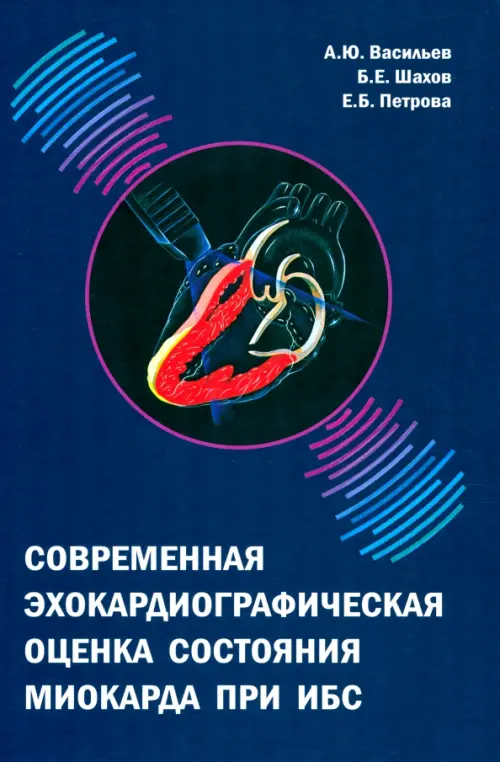 

Современная эхокардиографическая оценка состояния миокарда при ИБС, Синий