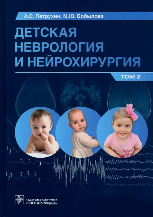 

Детская неврология и нейрохирургия. Учебник в 2 томах. Том 2, Синий