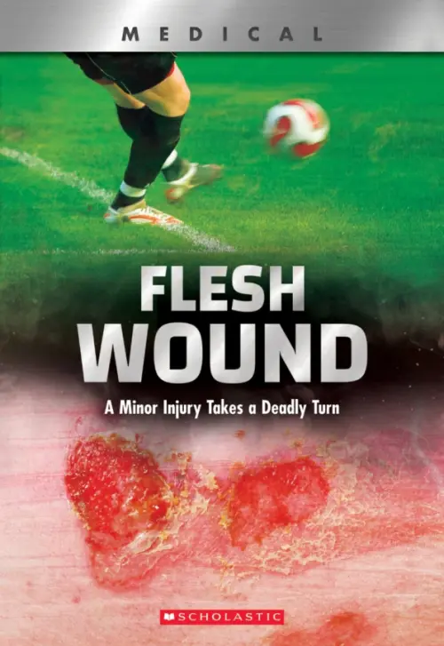 

Flesh Wound. A Minor Injury Takes a Deadly Turn