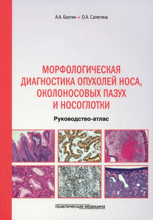 

Морфологическая диагностика опухолей носа, околоносовых пазух и носоглотки. Руководство-атлас, Фиолетовый