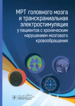 МРТ головного мозга и транскраниальная электростимуляция у пациентов с хроническим нарушением