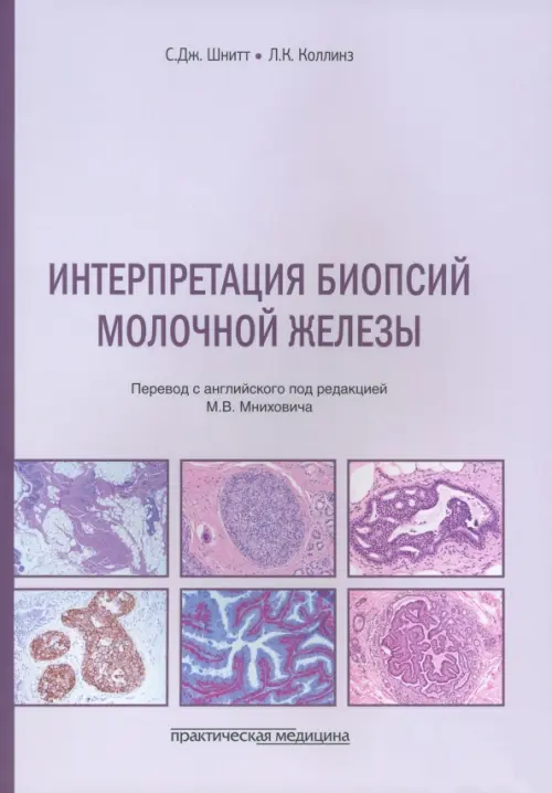 

Интерпретация биопсий молочной железы, Фиолетовый