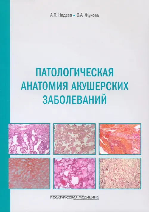 

Патологическая анатомия акушерских заболеваний, Белый